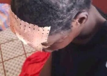 Kindia: une jeune dame sauvagement bastonnée par son petit ami (images sensibles)